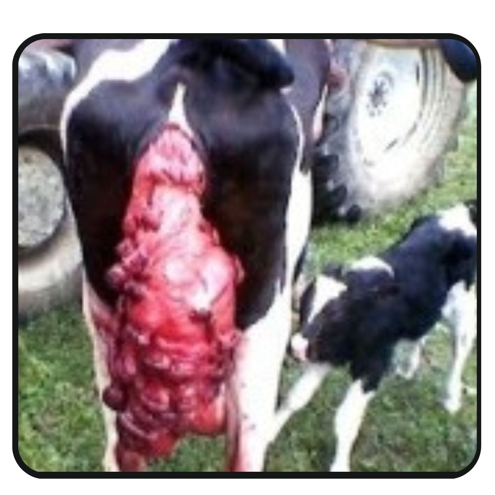 Post Partum Prolapse