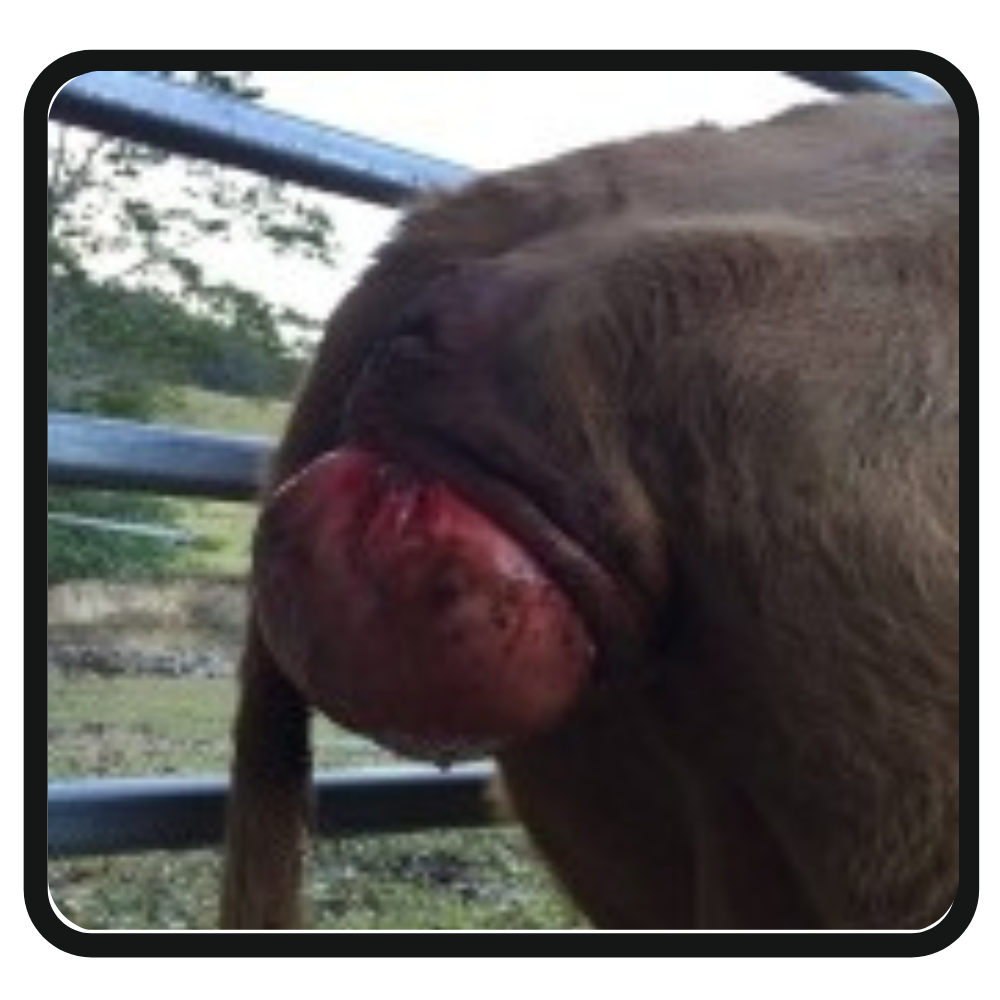 Pre Partum Prolapse